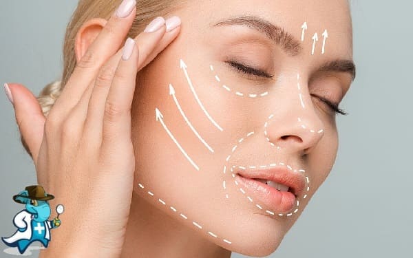 Lifting Facial Clínica DaVinci Albacete