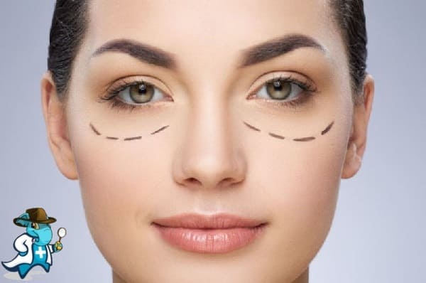 Relleno de Ojeras Clínica DaVinci Albacete